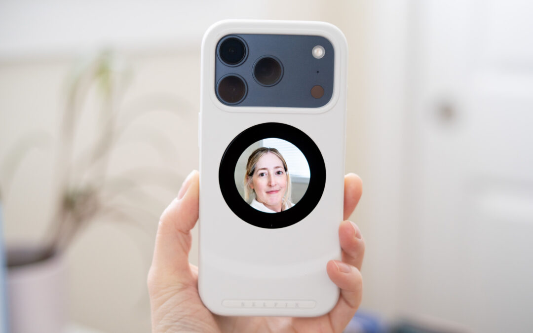 I wish this selfie phone case was better for selfies