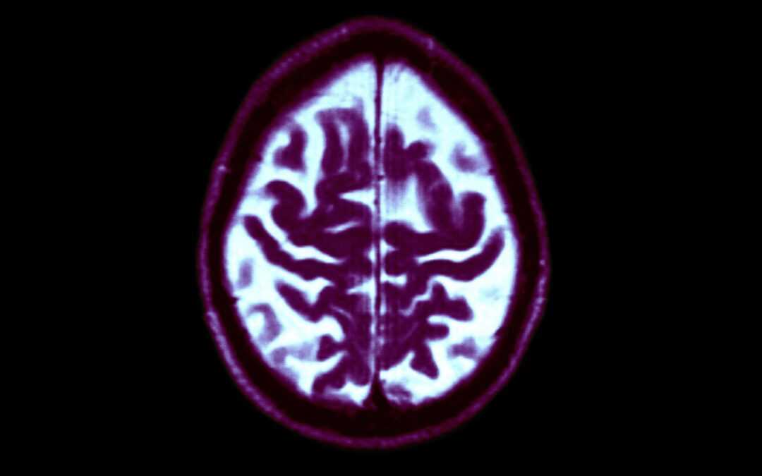 We’re not as helpless against dementia as we think