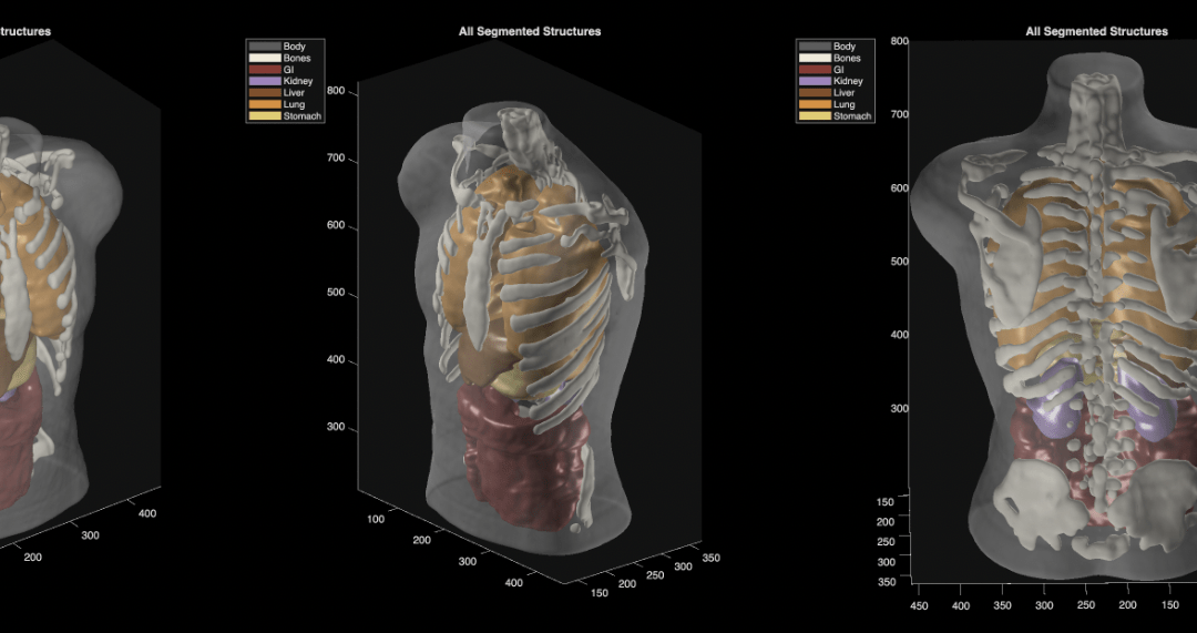 Midjourney Medical goes from generating ‘cat images’ to full-body ultrasound scans