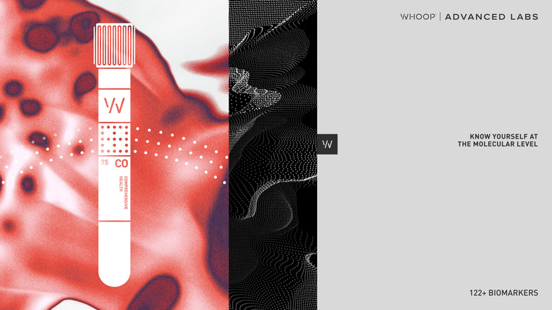 Whoop’s Advanced Labs health screenings will no longer require a subscription